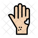 پیش‌نمایش فایل hand-acne-2863330 از پک حساسیت و آلرژی