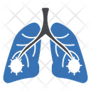 پیش‌نمایش فایل lungs-disease-2865255 از پک ویروس کرونا
