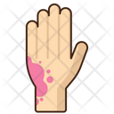 پیش‌نمایش فایل rash-5387448 از پک مراقبت از پوست