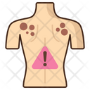 پیش‌نمایش فایل skin-cancer-5387454 از پک مراقبت از پوست