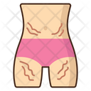 پیش‌نمایش فایل stretchmarks-5387462 از پک مراقبت از پوست