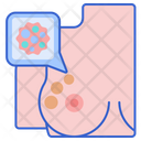پیش‌نمایش فایل breast-cancer-2780629 از پک سلامت زنان مردان