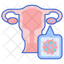 پیش‌نمایش فایل ovarian-cancer-2780572 از پک سلامت زنان مردان