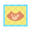 پیش‌نمایش فایل sonography-2108138 از پک نوزاد