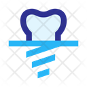 پیش‌نمایش فایل implant-tooth-2512732 از پک پزشکی و دارو