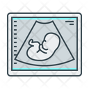 پیش‌نمایش فایل ultrasound-scanner-2344592 از پک پزشکی و دارو